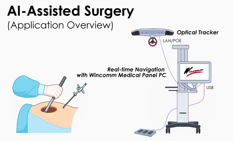 Application of WMP-K /S series Medical Edge AI Panel PCs Application of WMP-K /S series Medical Edge AI Panel PCs
