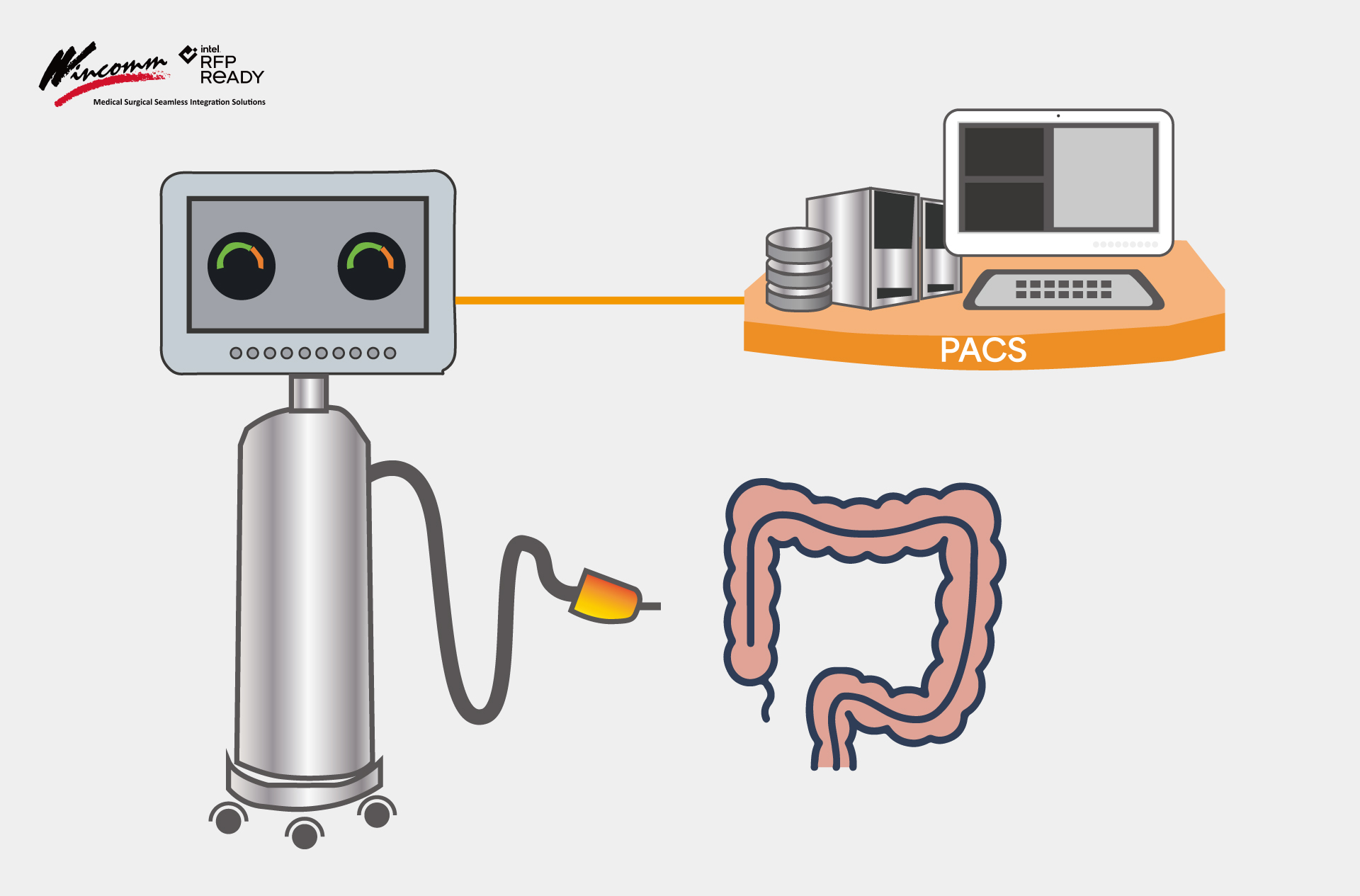 proimages/news/Successful_Stories/Innovation_Colonoscopy_Application_–Remote_Control_Panel/application-diagram_Colonoscopy-application.jpg